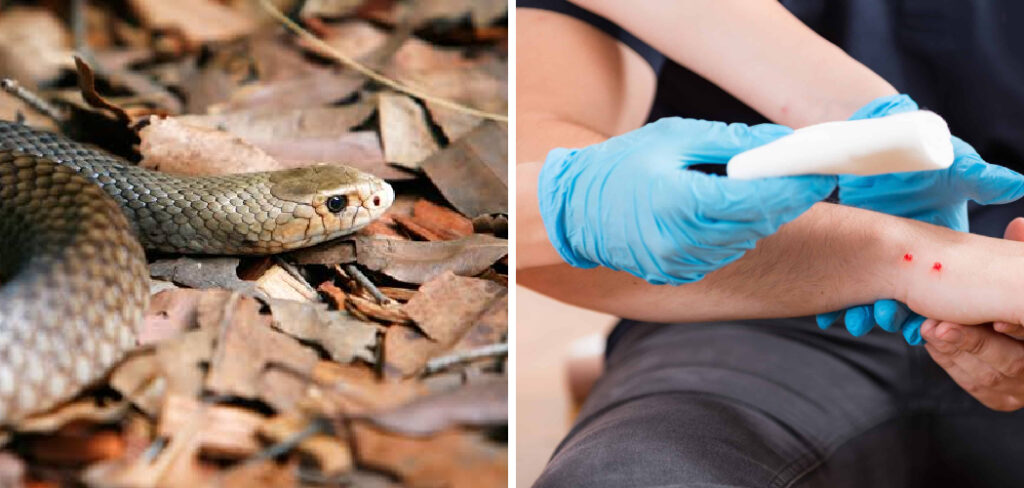 How to Treat a Snake Bite While Hiking